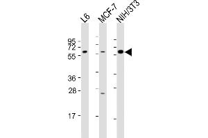 All lanes : Anti-YES1 Antibody (N-term) at 1:2000 dilution Lane 1: L6 whole cell lysates Lane 2: MCF-7 whole cell lysates Lane 3: NIH/3T3 whole cell lysates Lysates/proteins at 20 μg per lane. (YES1 抗体  (N-Term))