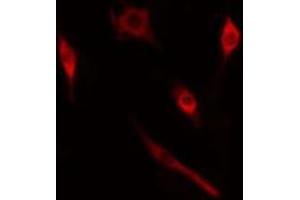 ABIN6274985 staining  HT29 cells by IF/ICC. (CRABP2 抗体  (Internal Region))