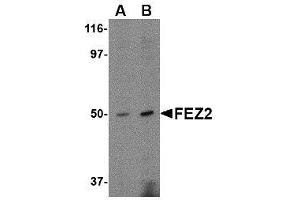 Western blot analysis of FEZ2 in mouse brain tissue lysate with AP30334PU-N FEZ2 antibody at (A) 0. (FEZ2 抗体  (C-Term))