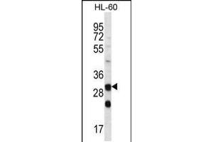 Western blot analysis in HL-60 cell line lysates (35ug/lane). (CA6 抗体  (C-Term))