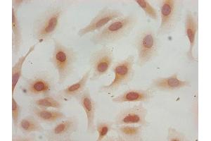Immunocytochemistry analysis of Hela cells using ABIN7139598 at dilution of 1:100 (HIST1H3A 抗体  (meLys36))