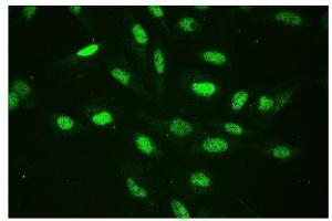 IF analysis of CTBP2 using anti-CTBP2 antibody (ABIN3042768). (CTBP2 抗体  (AA 321-445))