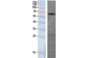 Western Blotting (WB) image for anti-GAD65+GAD67 (C-Term) antibody (ABIN3175202) (GAD65+GAD67 (C-Term) 抗体)