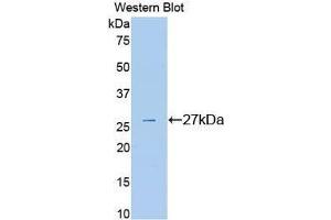 Western Blotting (WB) image for anti-Plasminogen (PLG) (AA 582-812) antibody (ABIN3207025) (PLG 抗体  (AA 582-812))