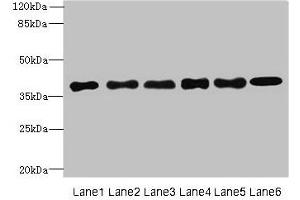 Western blot All lanes: TMEM68 antibody at 4 μg/mL Lane 1: Mouse thymus tissue Lane 2: K562 whole cell lysate Lane 3: U251 whole cell lysate Lane 4: HepG2 whole cell lysate Lane 5: MCF-7 whole cell lysate Lane 6: Jurkat whole cell lysate Secondary Goat polyclonal to rabbit IgG at 1/10000 dilution Predicted band size: 38, 30, 16 kDa Observed band size: 38 kDa (TMEM68 抗体  (AA 74-114))