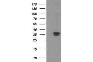 Western Blotting (WB) image for anti-Retinol Dehydrogenase 14 (All-Trans/9-Cis/11-Cis) (RDH14) antibody (ABIN1500656)