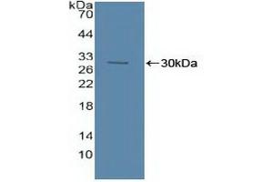 Detection of Recombinant ASM, Human using Polyclonal Antibody to Acid Sphingomyelinase (ASM) (SMPD1 抗体  (AA 319-579))