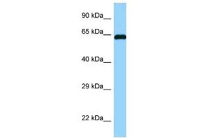 WB Suggested Anti-ABI1 Antibody Titration: 1. (ABI1 抗体  (N-Term))