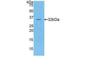 Detection of Recombinant PKCh, Human using Polyclonal Antibody to Protein Kinase C Eta (PKCh) (PKC eta 抗体  (AA 355-614))