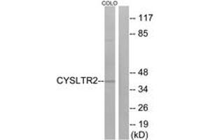 Western Blotting (WB) image for anti-Cysteinyl Leukotriene Receptor 2 (CYSLTR2) (AA 281-330) antibody (ABIN2890761) (CasLTR2 抗体  (AA 281-330))