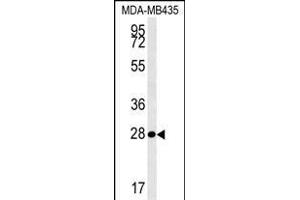 MRM1 Antibody (N-term) (ABIN654341 and ABIN2844111) western blot analysis in MDA-M cell line lysates (35 μg/lane). (MRM1 抗体  (N-Term))