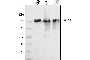 Western blot analysis of ZNF609 using anti-ZNF609 antibody (ABIN7599751).