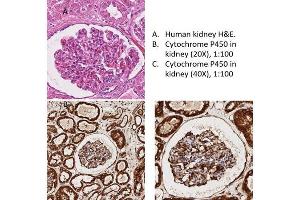 Immunohistochemistry (IHC) image for anti-Cytochrome P450, Family 1, Subfamily A, Polypeptide 1 (CYP1A1) antibody (ABIN6657370)