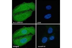 (ABIN768598) Immunofluorescence analysis of paraformaldehyde fixed U2OS cells, permeabilized with 0. (GPR183 抗体  (Internal Region))