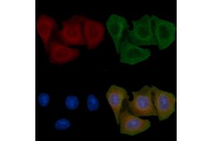 ABIN6257806 and ABIN6275277 staining Hela cells(45 min of heat-shock) by IF/ICC. (CYB5R1 抗体  (C-Term))