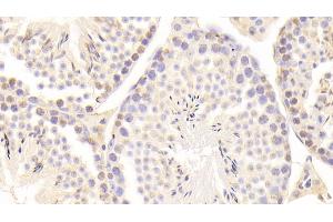 Detection of GAS6 in Mouse Testis Tissue using Polyclonal Antibody to Growth Arrest Specific Protein 6 (GAS6) (GAS6 抗体  (AA 483-646))