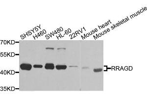 Western blot analysis of extracts of various cell lines, using RRAGD antibody. (RRAGD 抗体  (AA 181-400))