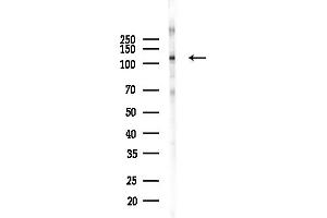 anti-Cas-Br-M (Murine) Ecotropic Retroviral Transforming Sequence (CBL) (Internal Region) antibody