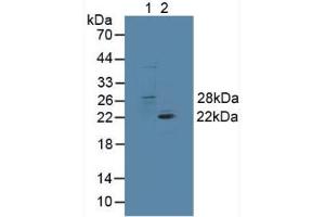 Figure. (GSTT1 抗体  (AA 7-240))