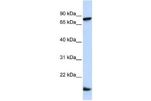 Western Blotting (WB) image for anti-Zinc Finger Protein 281 (ZNF281) antibody (ABIN2458356) (ZNF281 抗体)