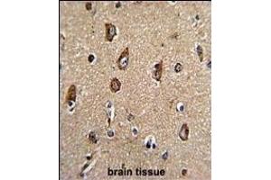 Immunohistochemistry (Paraffin-embedded Sections) (IHC (p)) image for anti-RAB5A, Member RAS Oncogene Family (RAB5A) (AA 182-211), (C-Term) antibody (ABIN390962)