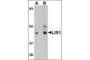 Western blot analysis of LIS1 in HeLa cell lysate AP30511PU-N at (A) 0. (PAFAH1B1 抗体  (C-Term))