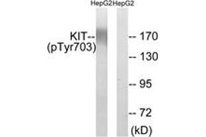 Western Blotting (WB) image for anti-Mast/stem Cell Growth Factor Receptor (KIT) (AA 671-720), (pTyr703) antibody (ABIN1531334)