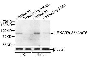 Western blot analysis of extracts of HeLa and 293 cells, using Phospho-PKCδ/θ-S643/676 antibody (ABIN5996816) at 1/1000 dilution. (PKC delta/theta (pSer643), (pSer676) 抗体)