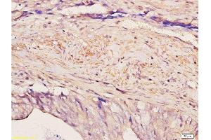 Immunohistochemistry (Paraffin-embedded Sections) (IHC (p)) image for anti-Zinc Finger and BTB Domain Containing 7A (ZBTB7A) (AA 151-250) antibody (ABIN729448)