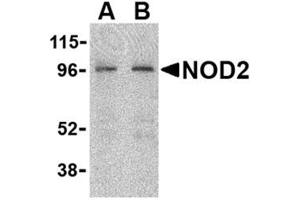 Image no. 1 for anti-Phorbol-12-Myristate-13-Acetate-Induced Protein 1 (PMAIP1) (N-Term) antibody (ABIN318707) (NOXA 抗体  (N-Term))