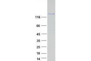 Western Blotting (WB) image for Transcription Elongation Factor SPT5 (SUPT5H) (Transcript Variant 4) protein (Myc-DYKDDDDK Tag) (ABIN2733008)