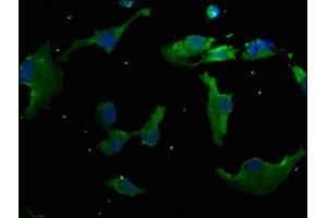 Immunofluorescence staining of U251 cells with ABIN7140118 at 1:50, counter-stained with DAPI. (RHBDD3 抗体  (AA 304-323))