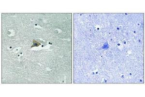 Immunohistochemical analysis of paraffin-embedded human brain tissue using Claudin 5 (Phospho-Tyr217) antibody (left)or the same antibody preincubated with blocking peptide (right). (Claudin 5 抗体  (pTyr217))
