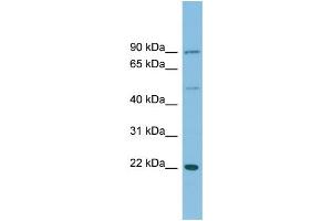 anti-DnaJ (Hsp40) Homolog, Subfamily C, Member 12 (DNAJC12) (Middle Region) antibody