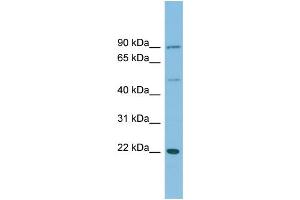 WB Suggested Anti-DNAJC12 Antibody Titration: 0. (DNAJC12 抗体  (Middle Region))