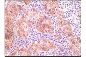 Immunohistochemistry (IHC) image for anti-Synuclein, gamma (Breast Cancer-Specific Protein 1) (SNCG) (truncated) antibody (ABIN2464104) (SNCG 抗体  (truncated))
