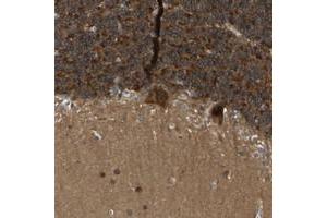 Immunohistochemical staining of human cerebellum with NDRG3 polyclonal antibody  shows strong cytoplasmic positivity in purkinje cells and in cells of granular layer at 1:20-1:50 dilution. (NDRG3 抗体)