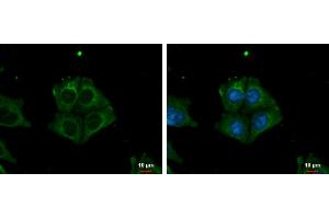 ICC/IF Image TRIM32 antibody detects TRIM32 protein at cytoplasm by immunofluorescent analysis. (TRIM32 抗体)