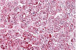 ABIN571194 (5µg/ml) staining of paraffin embedded Human Adrenal Gland. (ETFA 抗体  (AA 139-152))