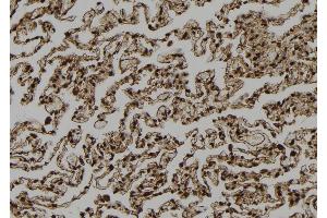 ABIN6272990 at 1/100 staining Human lung tissue by IHC-P. (AGTPBP1 抗体  (Internal Region))