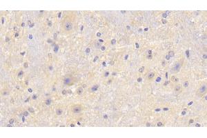 Detection of F5 in Mouse Cerebellum Tissue using Polyclonal Antibody to Coagulation Factor V (F5) (Coagulation Factor V 抗体  (AA 1863-2161))