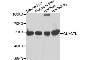 Western blot analysis of extracts of various cell lines, using GLYCTK antibody. (GLYCTK 抗体)