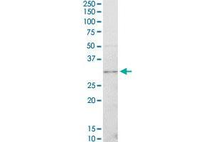 Western Blotting (WB) image for anti-Cyclin-Dependent Kinase 4 (CDK4) (AA 211-303) antibody (ABIN560292)