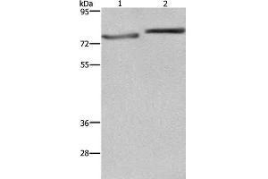 Western Blot analysis of PC3 and Hela cell using COMP Polyclonal Antibody at dilution of 1:600 (COMP 抗体)