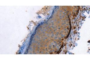 Immunohistochemistry of paraffin-embedded Human skin using Caldesmon Polyclonal Antibody at dilution of 1:40 (Caldesmon 抗体)