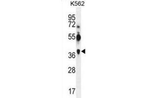 Western Blotting (WB) image for anti-Melanoma Antigen Family A, 12 (MAGEA12) antibody (ABIN3002530) (MAGEA12 抗体)