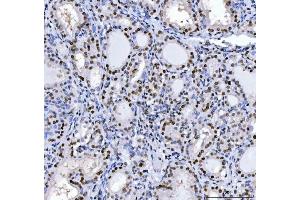 IHC analysis of MBNL1 using anti-MBNL1 antibody (ABIN7602608).
