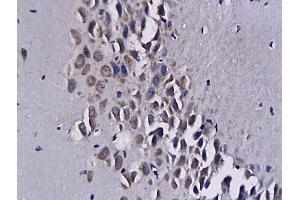 Formalin-fixed and paraffin embedded mouse brain tissue  labeled with Anti-CXCL16 Polyclonal Antibody, unconjugated  (ABIN686572) followed by incubation with conjugated secondary antibody and DAB staining (CXCL16 抗体  (AA 85-200))