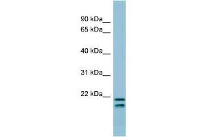 WB Suggested Anti-SFTPC Antibody Titration:  0. (Surfactant Protein C 抗体  (N-Term))