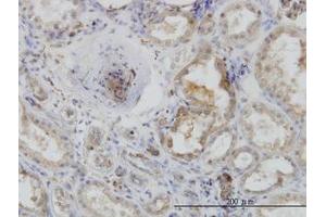 Image no. 4 for anti-Actin-Related Protein 2 (ACTR2) (AA 1-395) antibody (ABIN599116) (ACTR2 抗体  (AA 1-395))